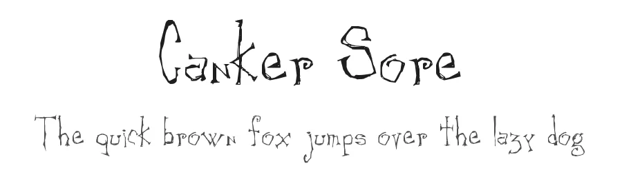 Canker Sore
