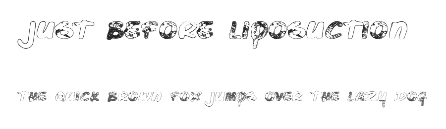 Just Before Liposuction